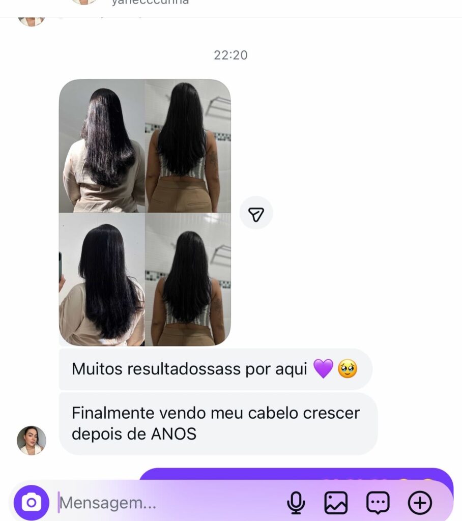 Resultado Musas Hair 5