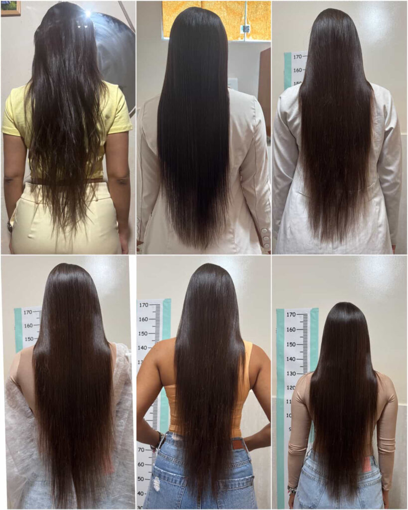 Resultado Musas Hair 6