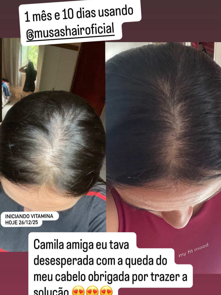 Resultado Musas Hair 1